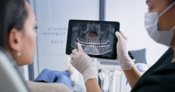 Licensed Tooth Extraction service in Springfield, MA - Smile Center Dentistry